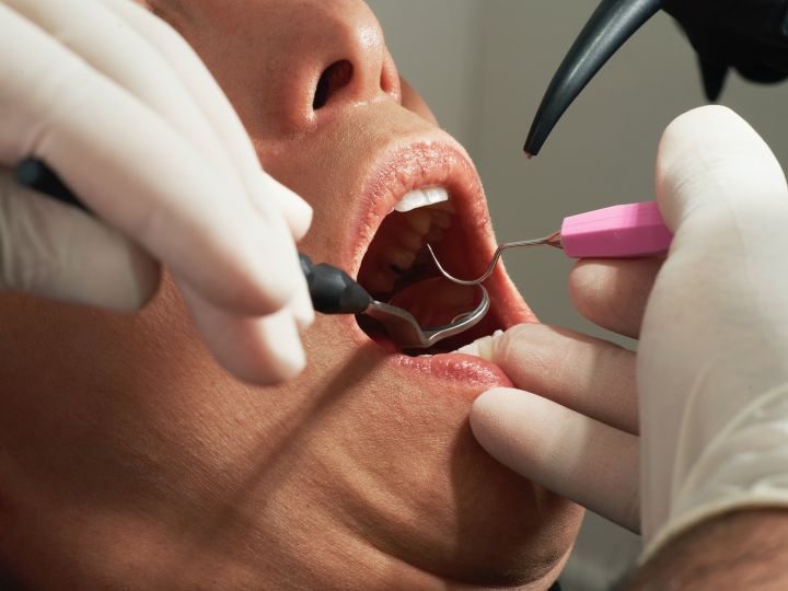 Кемеровчане сочли «издевательством» очереди к стоматологам 