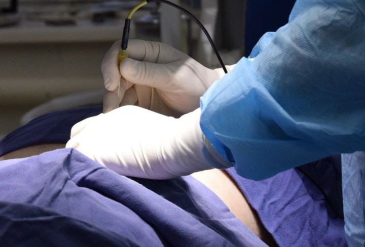 Кузбасские врачи помогли пациенту сохранить почку 