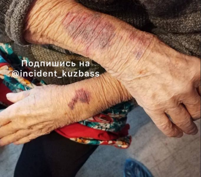 СК начал проверку после сообщений об избиении бабушки в пансионате в Новокузнецке