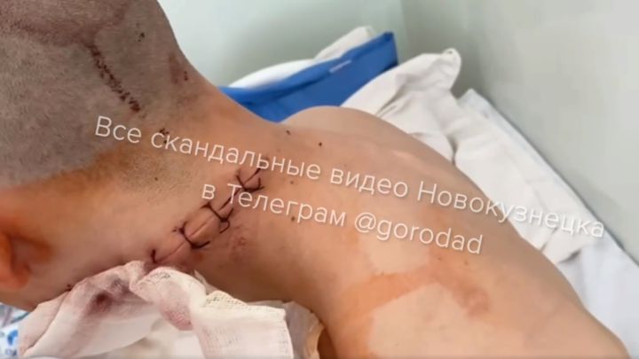 Новокузнечанин получил срок за кровавое нападение с мачете на молодого парня 